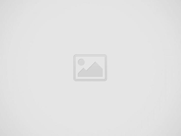 Un uomo sottoposto a trapianto di capelli